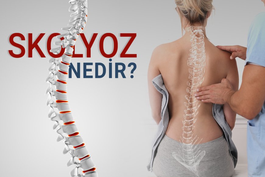 Skolyoz Nedir,  Tanı, Belirtiler ve Tedavi Yöntemleri Hakkında