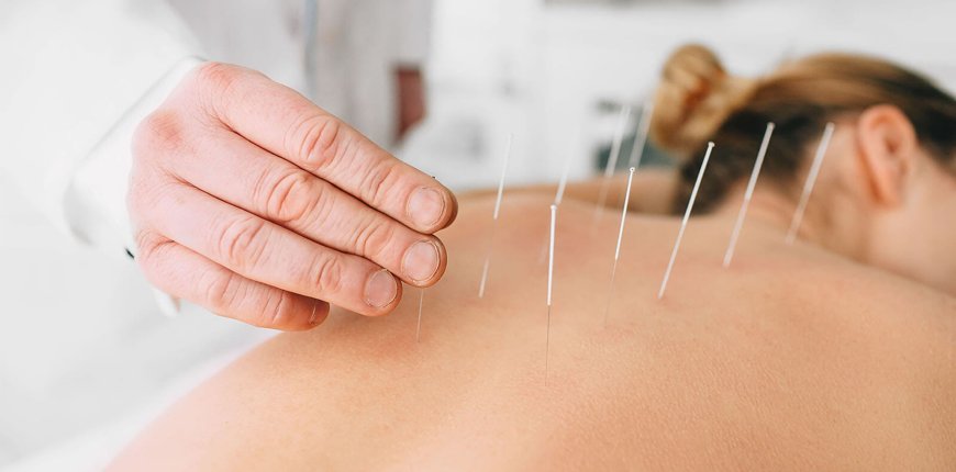 Akupunktur nedir, nasıl yapılır, faydaları ve zararları tam 35 madde ile bir farklı bakış